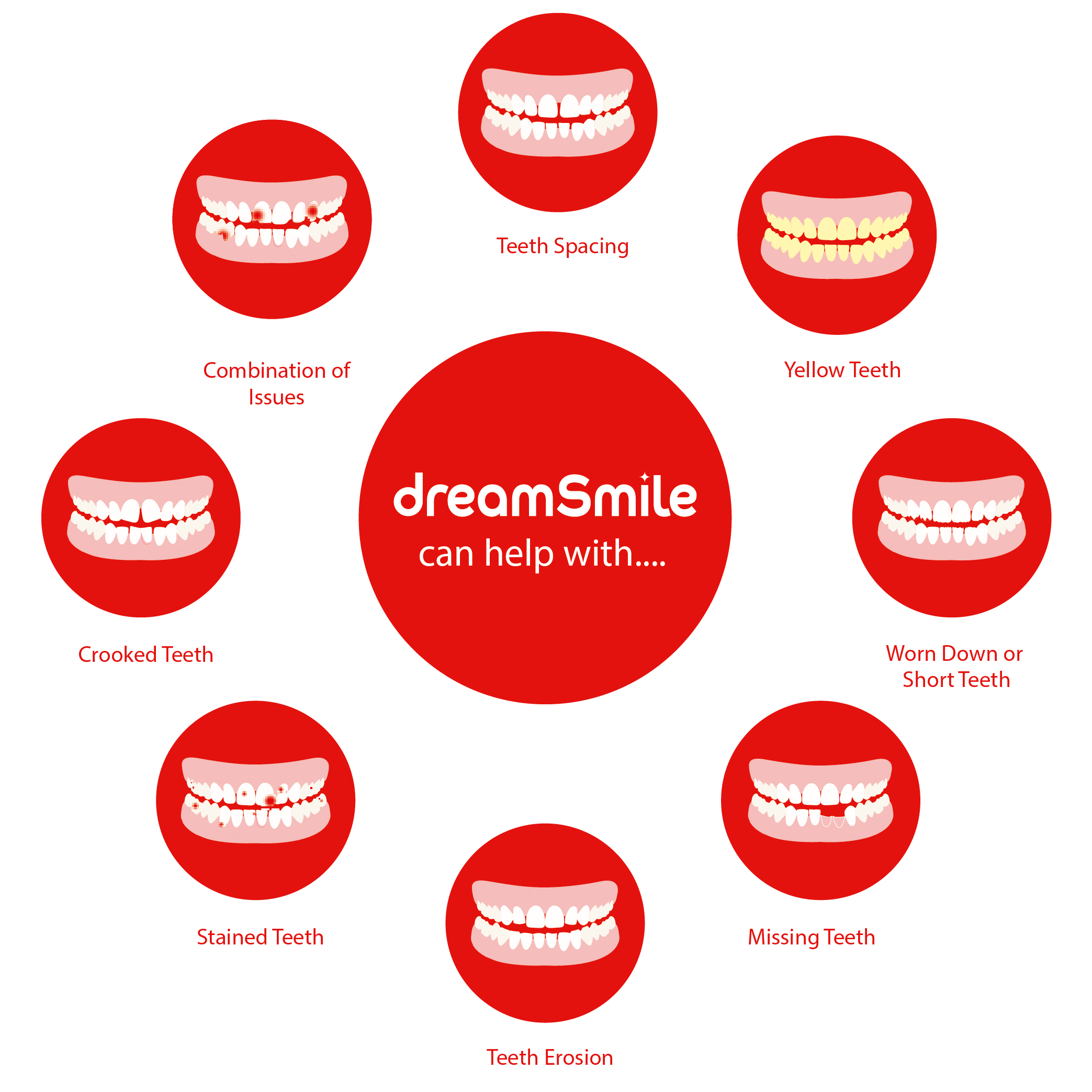 Dreamsmile-veneers-can-help-you-with-mobile