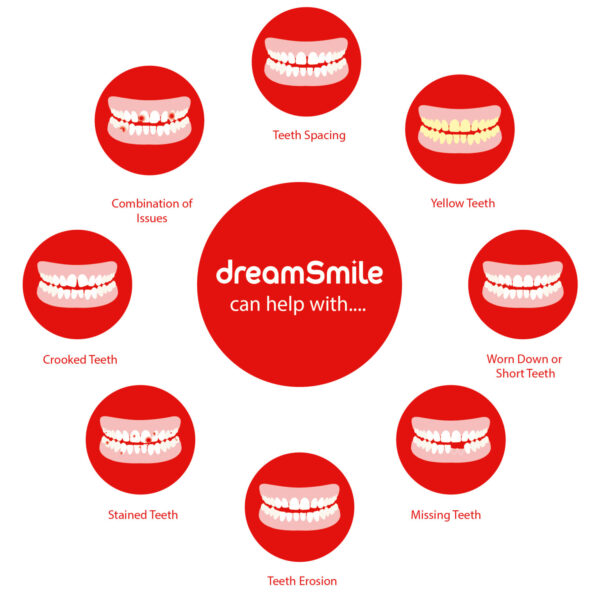 Dreamsmile Veneers Impression Kit / Scan - Image 10