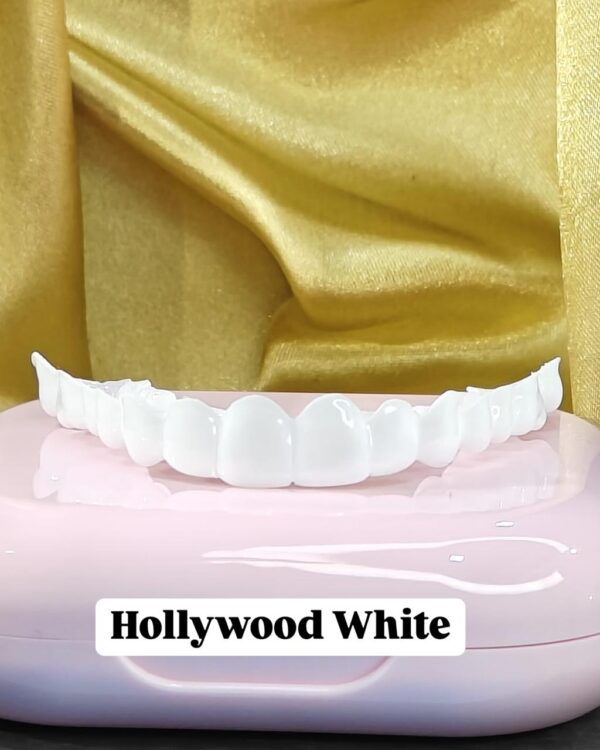 Dreamsmile Veneers Impression Kit / Scan - Image 2
