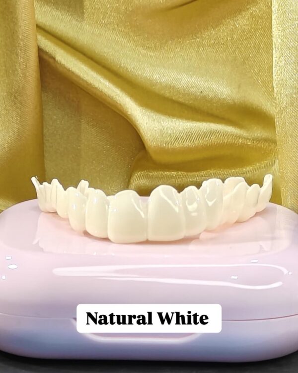 Dreamsmile Veneers Impression Kit / Scan - Image 3